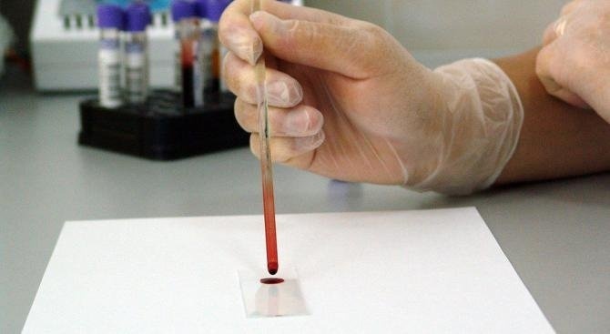 Нови 11 случая на хепатит А са регистрирани в Ловешка