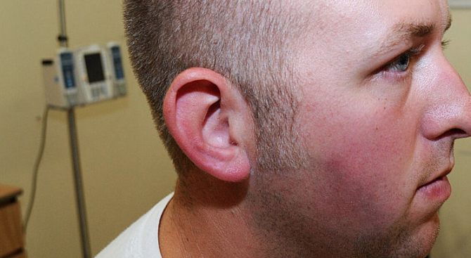 Британски лекар извади от пациент рекордно голямо цяло парче ушна