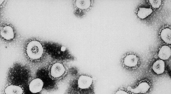 Генетични тестове могат да открият новия коронавирус в рамките на